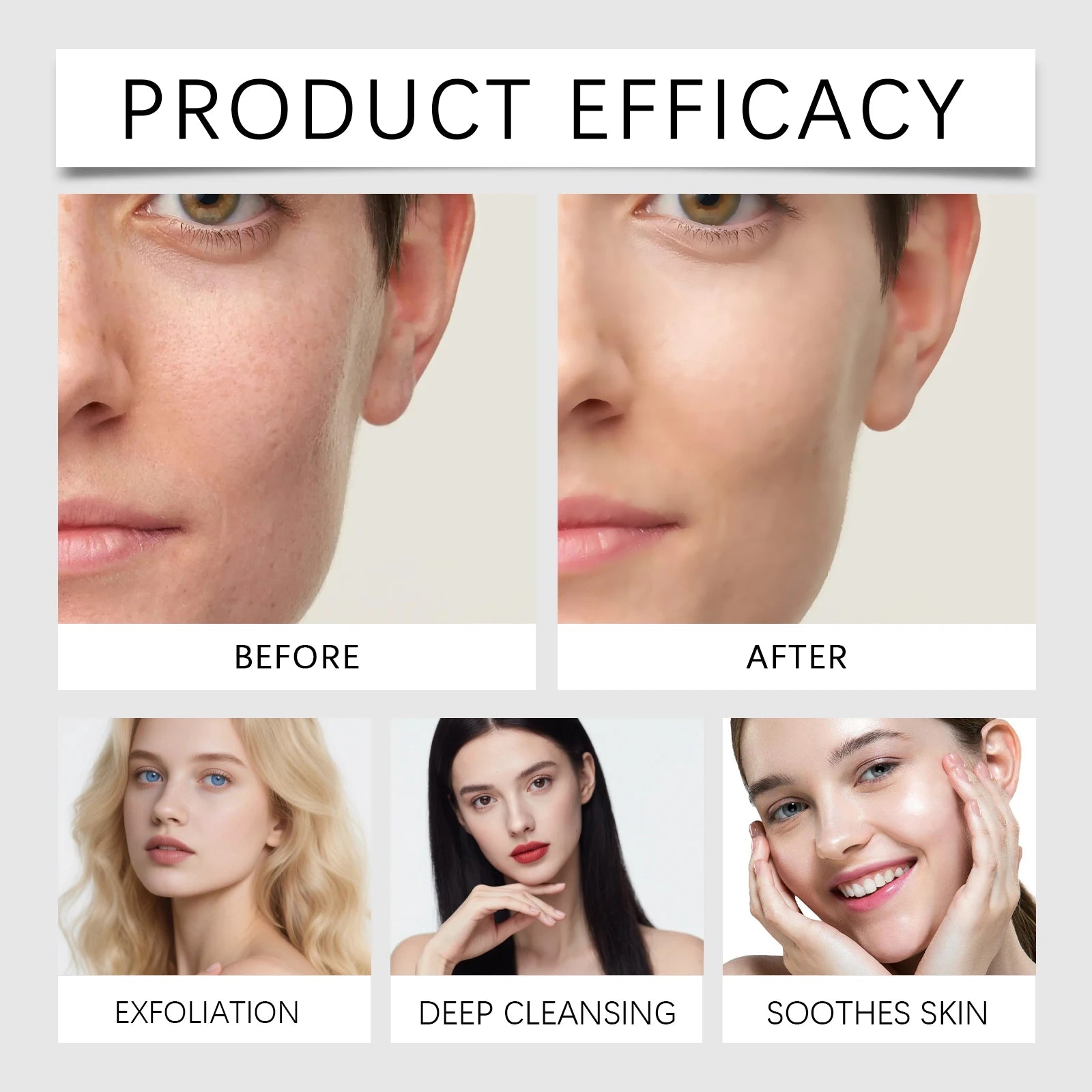 Korean Exfoliating Facial Serum Cleansing Pores Remove Dead Skin Purify Oil Control Smoothing Brightening Moisturizing Ampoule